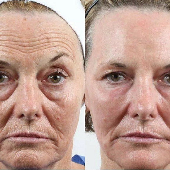 Shani Darden by Déesse PRO LED Light Mask FDA approved 
LED Light Therapy mask - Picture 9 of 12